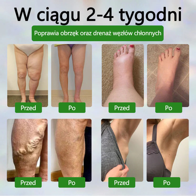 🌿ATTDX® Krem ziołowy łagodzący obrzęki z czarnuszką
