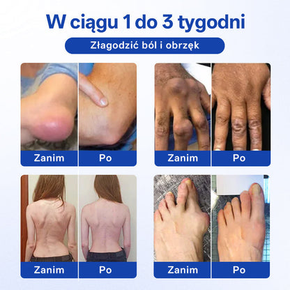 🔥🔥Timilk® BPC-157 Żel w kulce do regeneracji stawów i kości