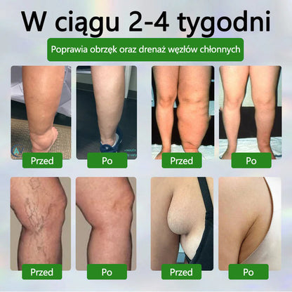 🌿ATTDX® Krem ziołowy łagodzący obrzęki z czarnuszką