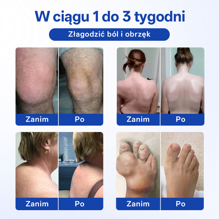 🔥🔥Timilk® BPC-157 Żel w kulce do regeneracji stawów i kości