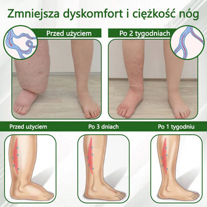 🌿ATTDX® Krem ziołowy łagodzący obrzęki z czarnuszką