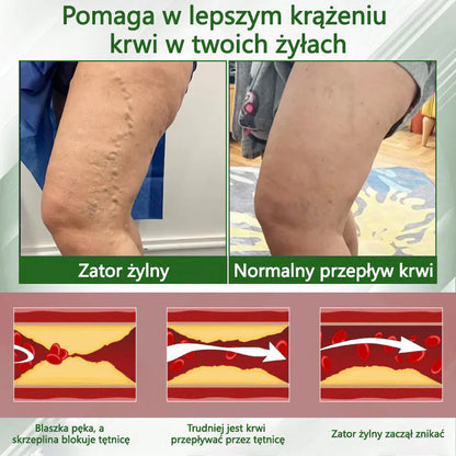 🌿ATTDX® Krem ziołowy łagodzący obrzęki z czarnuszką
